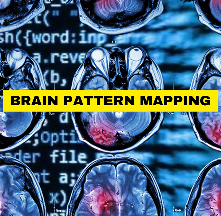 Brain Pattern Mapping (P) – Rewire Lab INC